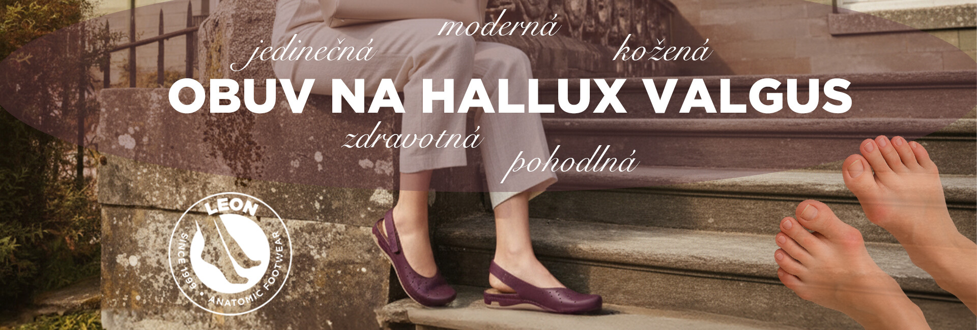 Hallux Valgus